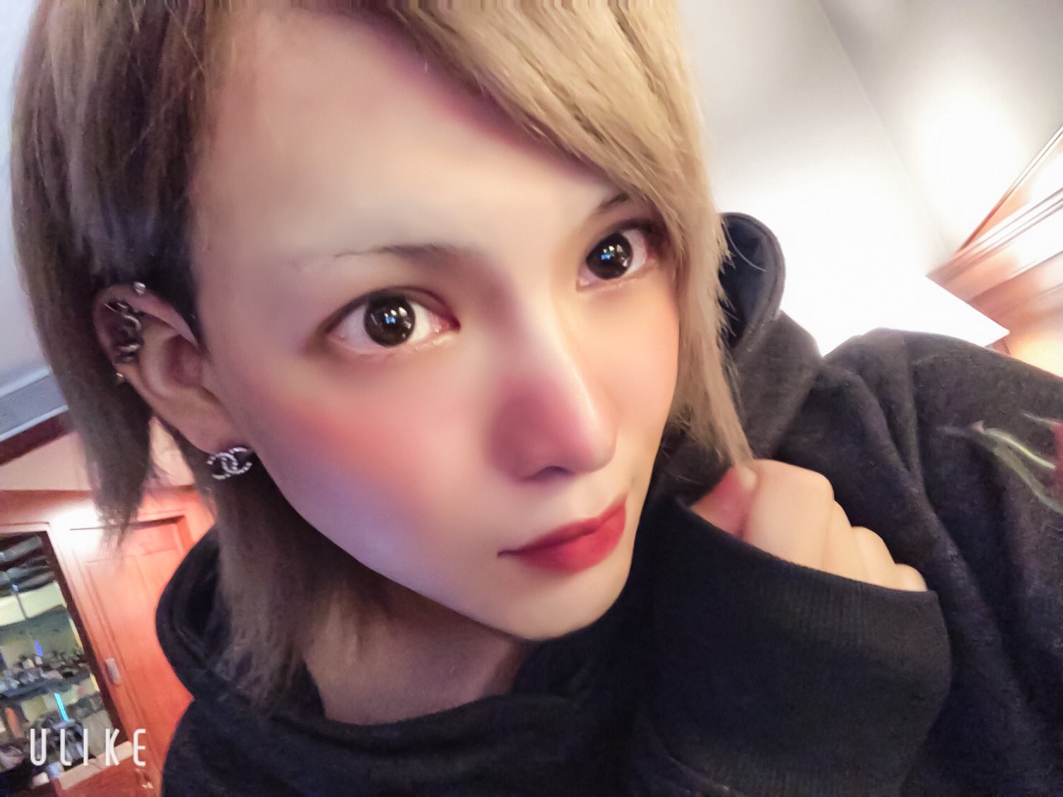 Pay 久しぶりの完全すっぴん 目の下一帯の毛穴レーザーで焼いたからめっちゃ赤い しめっちゃ痛いメイクできない 目指せ赤ちゃん肌 T Co Gfx6q7o4gh Twitter Pay 久しぶりの完全すっぴん 目の下一帯の毛穴レーザーで焼いたからめっちゃ赤い しめっちゃ痛いメイクできない 目指せ赤ちゃん肌 T Co Gfx6q7o4gh Twitter