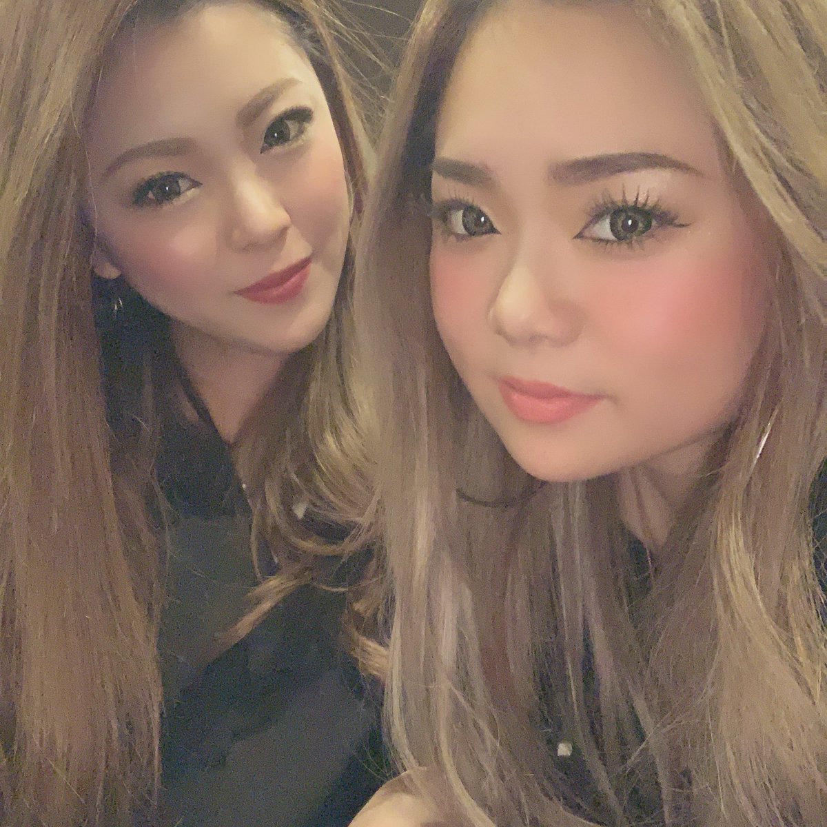 329chaaan's tweet image. まだ半分顔腫れてる🙁💦　#linkcode