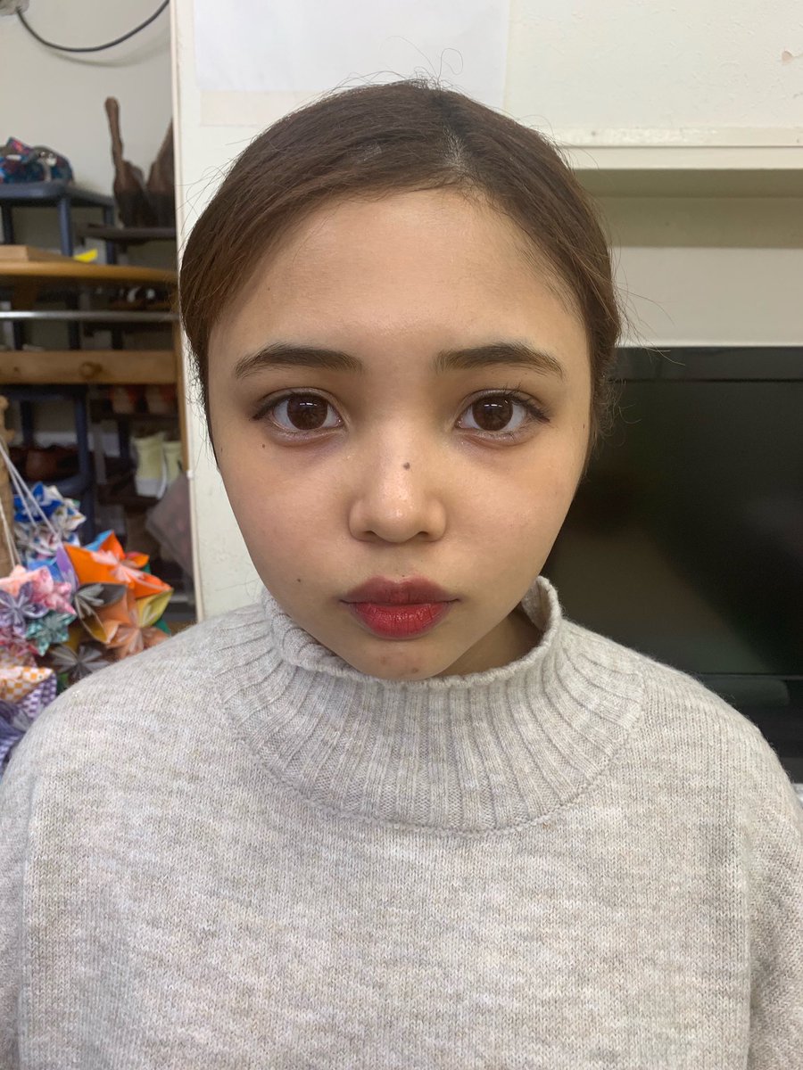 momo8kuro's tweet photo. 小顔矯正いったら逆に顔腫れたんだけどwwwwwwwwwwwwwwwwwwビフォーアフターみて永遠に笑ってるwwwwwwwwwwww https://t.co/l3rv5Ecr0B