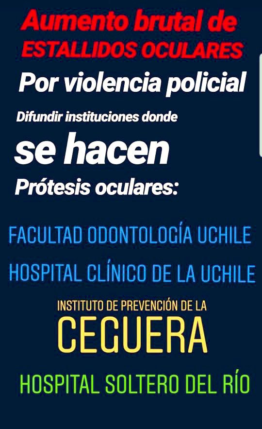 cristrubilar's tweet photo. #EnChileNosDejanCiegos TODA persona que haya sufrido una #estallidoocular se pueden realizar #protesisocular yo las hago 100% sin costo en #hospitalsoterodelrio ademas existen otras instituciones de gran experiencia porfavor ayudame con tu #RT en apoyo a Gustavo Gatica 🙏 https://t.co/b1X2PkR3vo