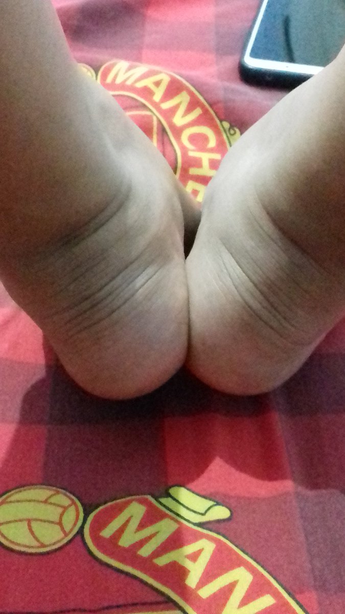kuaciii28's tweet photo. #papdepanmu
kaki gua keriput maemunaaah
#penuaandini https://t.co/odViLu3CHT