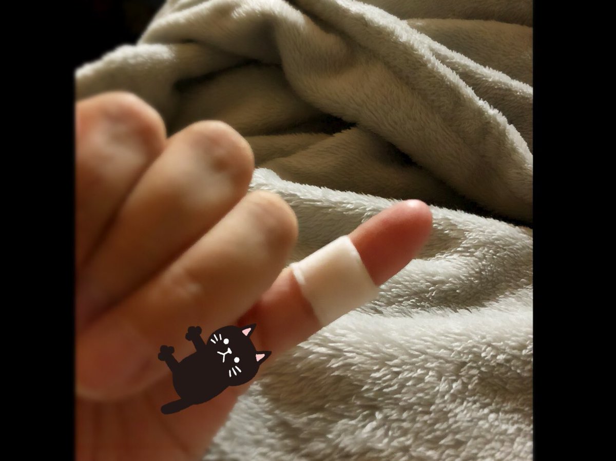 小指湿布 Hashtag On Twitter