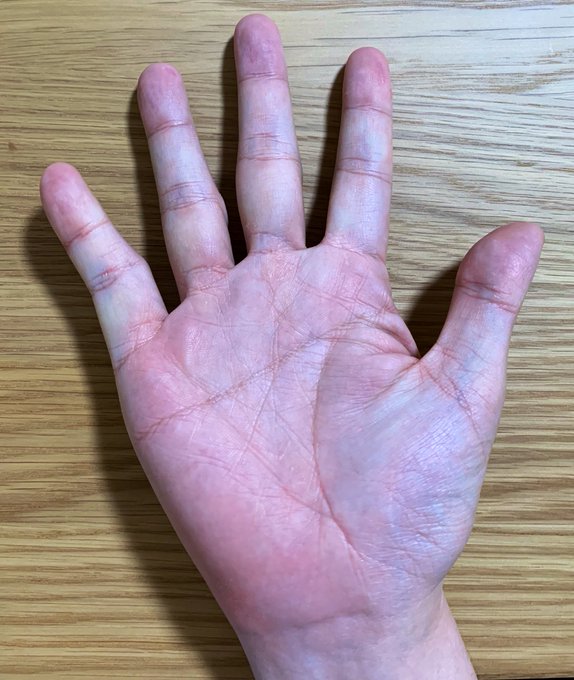 ますかけ線の見方は 百握りとも呼ばれる強運手相の意味や種類について紹介 セレスティア358