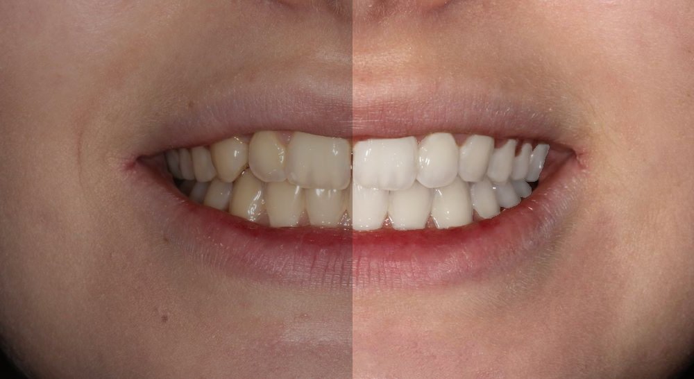 jubed00's tweet image. Photo Editing &amp;amp; Photo Retouching

#photo_editing #Background_remove #object_remove #photo_retouching #Photoshop #skin_retouch_action #skin_softening #beauty #baby_skin_retouch