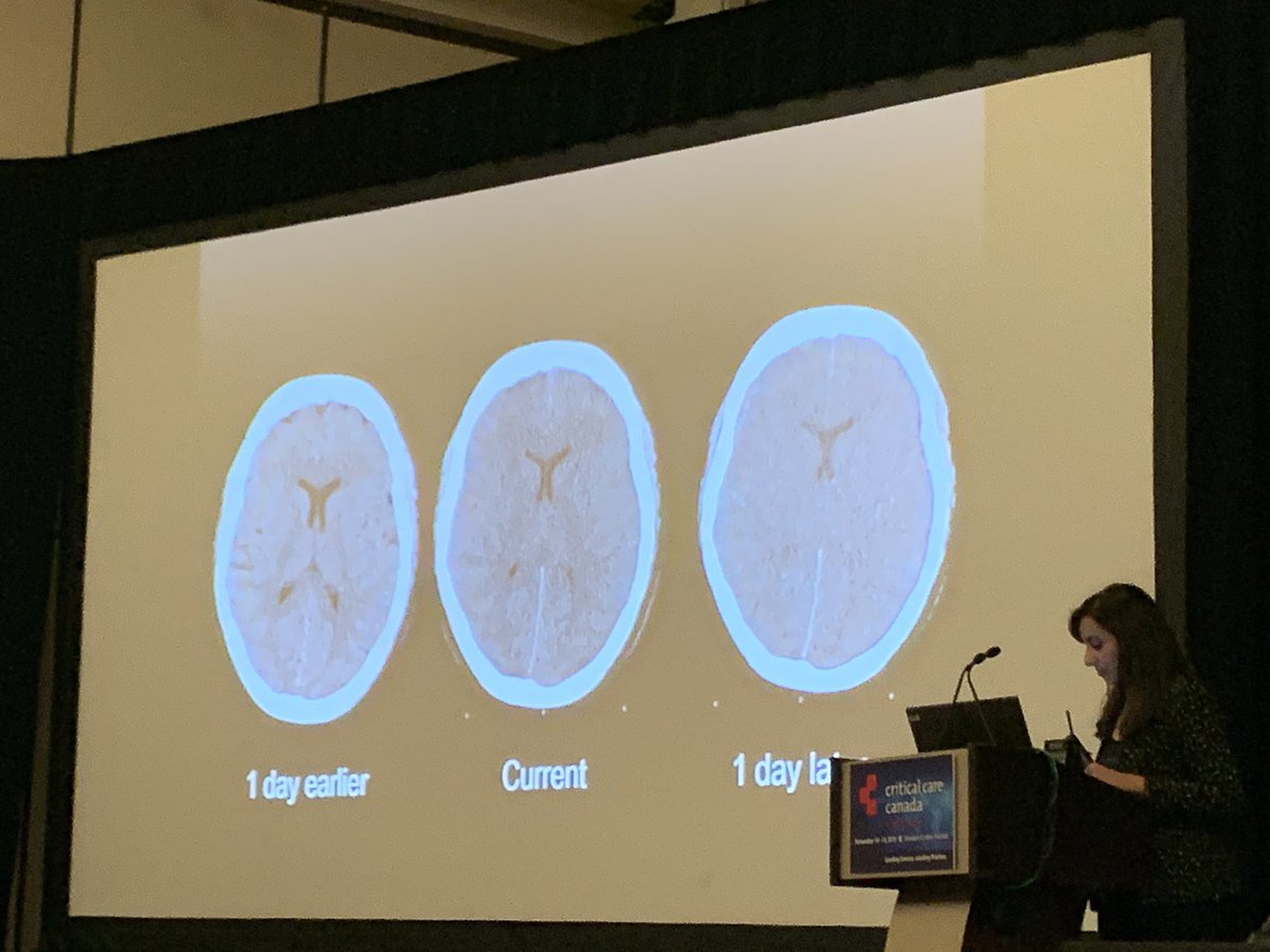 UofTNeuroCrit's tweet photo. We are up to #8: grey out sign indicating cerebral edema. Always put into context, patient movement, day of admission, age. #NCCMasterclass #CCCF2019 https://t.co/UTH4OPnjhS