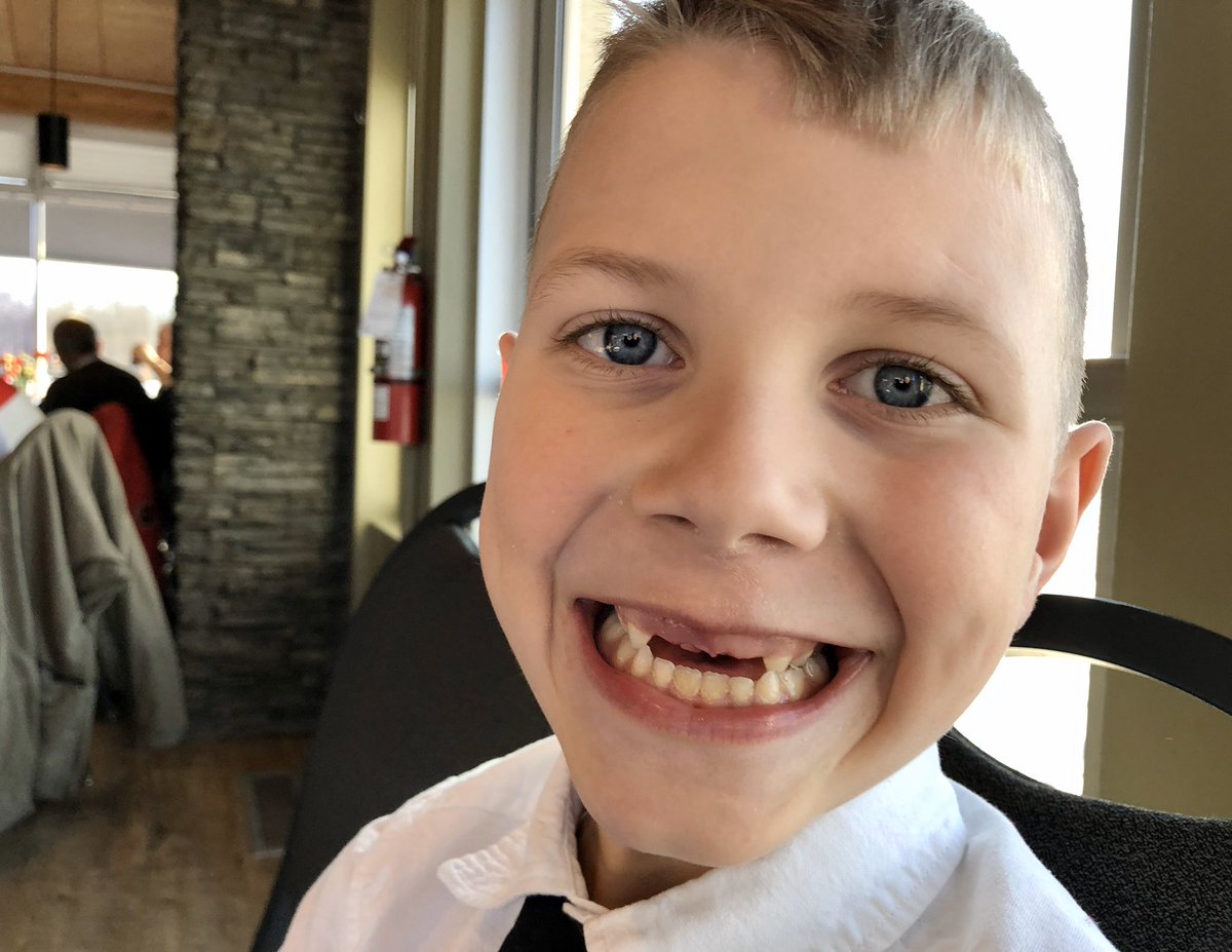 Conal_Mac's tweet photo. My son lost his FOURTH front tooth today. Now, he can do a better Brent Burns impression than @Burnzie88 can do himself. #ToothlessGrin https://t.co/T8qZtZmOuY