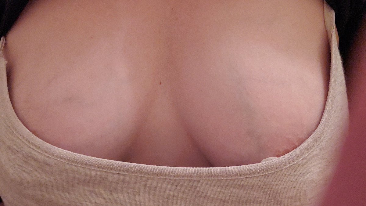 1sweetGoddess's tweet photo. #lactationedition #lactationfetish #milkfetish #lactophile #liquidgold #breastfeeding #nippleplay #hucow #eroticlactation #anr #abf #bigboobs #milkytits #bignipples #bigtits #nipples #boobswithmilk #tittenmilch #titten #milk #breastmilk https://t.co/pB2azF3t87