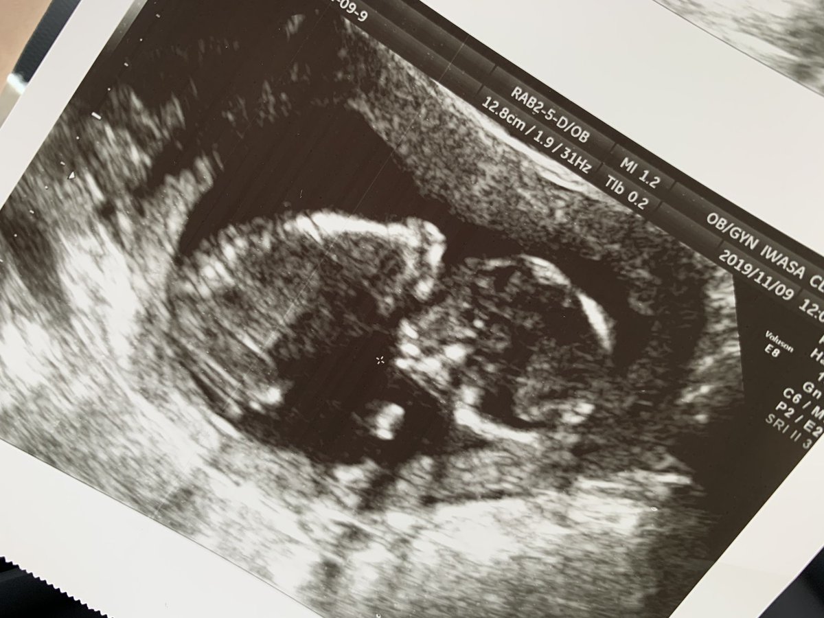 38syya's tweet photo. ご報告💍👶❤️
本日より橋本早耶になりました‼︎
それとお腹の中に5月初めに
生まれてくる赤ちゃんもいます☺️
たくさん苦労もすると思うけど2人で乗り越えて必ず幸せになろうね💭
これからも宜しくお願いします🥺❤️ https://t.co/1XZ75bnlek