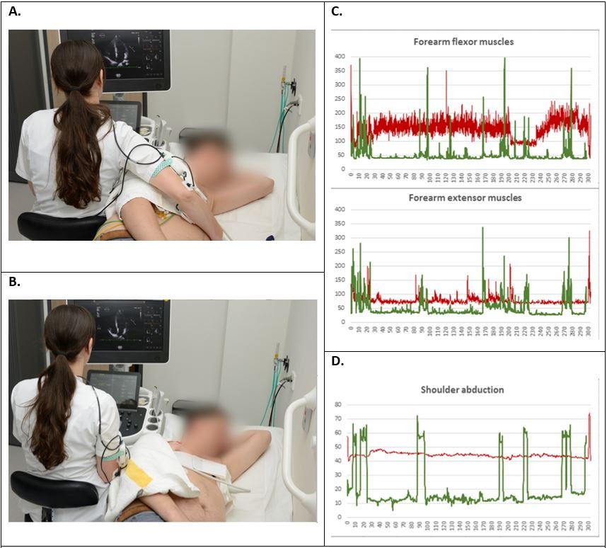 usono's tweet photo. Read our latest #publications: Reduced musculoskeletal overload, non-invasive cardiac output monitoring and custom ProbeFix designs for dynamic research.  
https://t.co/dqdDqBO10D
#ProbeFix #usono #echofirst #cvimaging #WRMSD #cardiacoutput #marathon #philipslumify #telemed https://t.co/OjmWbQXxRM