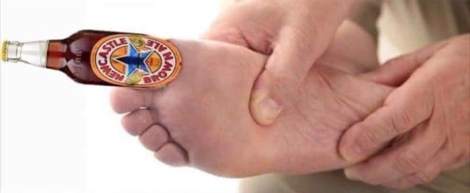 UKNoContext's tweet photo. think i’ve got an ingrown toon ale https://t.co/hAlRce4qrd