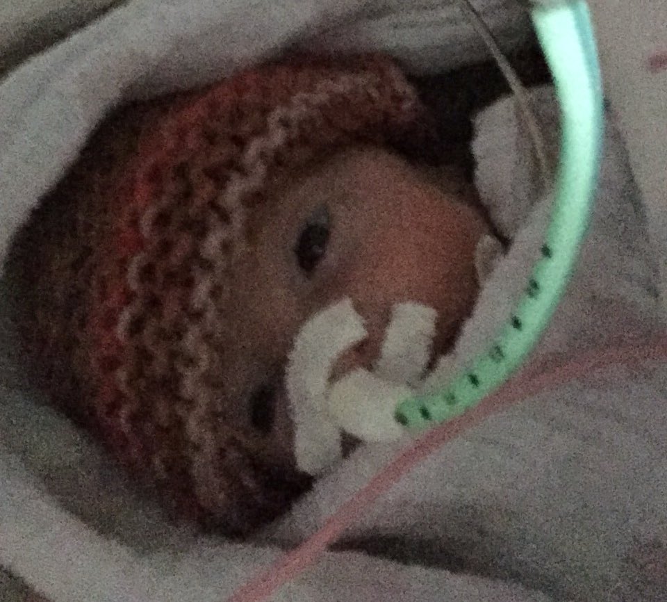 Le_Poukie's tweet photo. Tu nous a fait tellement peur hier, ton grand frère a pris la meilleure décision pour toi et il t’a probablement sauvé la vie ! Tu es plus forte que nous.  #grandfrere #soeur #chu #premature #1kg #love #strong #force #love https://t.co/OdgZNx8zvq