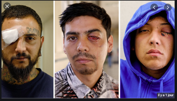 cyberdisruptor's tweet photo. #stopteargas #lbd #gilesjaunes #chileresiste #chiledespierto the victims of chemical weapons in 1917 and those in 2019 of the 'non-lethal weapons' .... time to limit the use and prosecure the abuse .... its time has come @ifrc https://t.co/X0MtxPMDdE