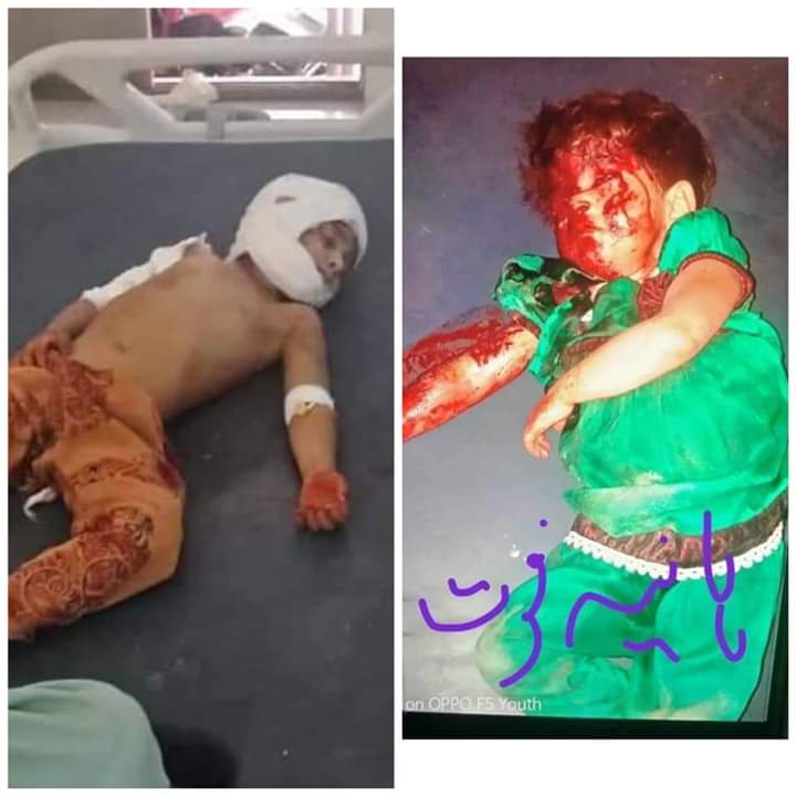 DrAfghan1's tweet photo. فاٹا میں ہمارےبچوں ہمارےنسل کشی کیلئے اوگائے گئے لینڈمائنز اس دلال میڈیا پر دھشتگردوں کے نام سے بتائے جارہےہیں لیکن آگر کوئی ثبوت مانگ کر کہ ایک دھشتگر تو بتایا جائے جو اسکا شکار ہوا ہو تو ترجمان فساد جناب غفورے @peaceforchange ان کو غدار اور شرپسند پکارتے ہیں
#DemineExFATA https://t.co/TfnmHOsAaH