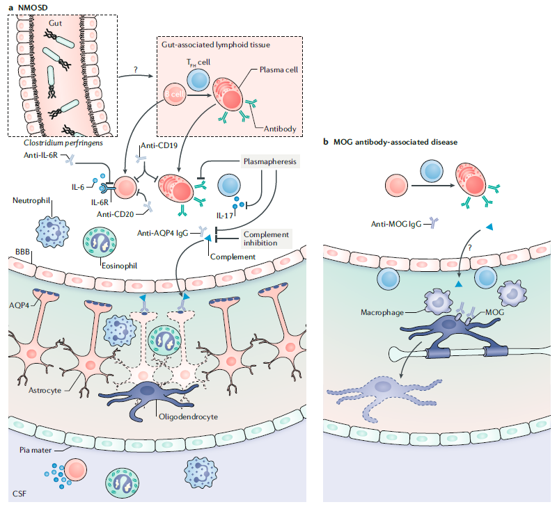 Nature Rev Neurosci (@natrevneurosci) on Twitter photo How do B cells contribute to CNS diseases? Read this new Review by Joseph Sabatino Jr, Anne-Katrin Pröbstel (<a href="/akproebstel/">Anne-Katrin Pröbstel</a>) and Scott Zamvil #Bcells go.nature.com/2KciBXs How do B cells contribute to CNS diseases? Read this new Review by Joseph Sabatino Jr, Anne-Katrin Pröbstel (<a href="/akproebstel/">Anne-Katrin Pröbstel</a>) and Scott Zamvil #Bcells go.nature.com/2KciBXs