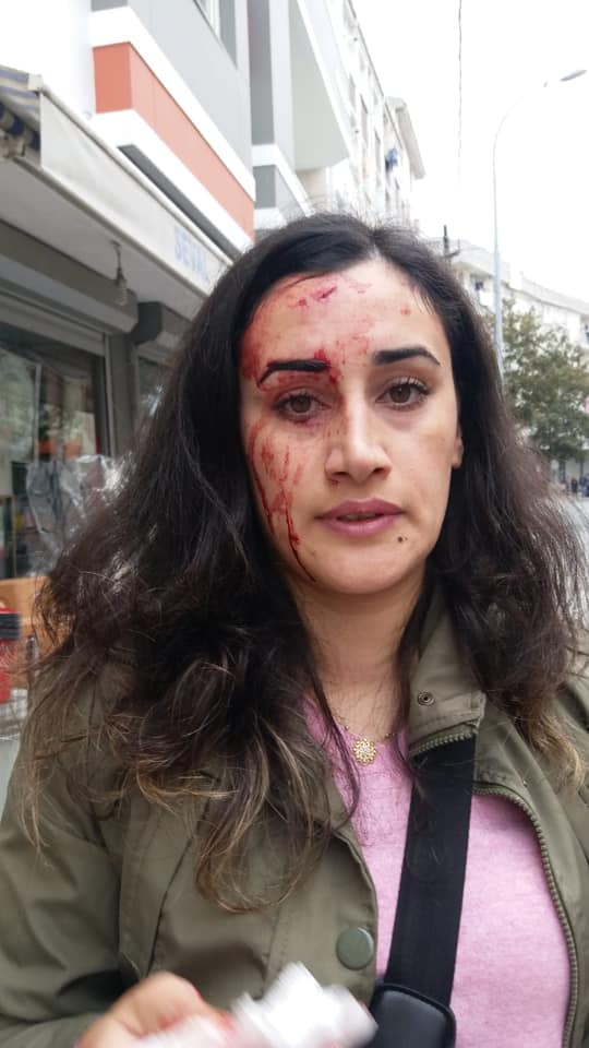 İstanbul Esenyurt'ta bulunan Cihan Tekstil'den tazminatsız atılan işçi Reyhan Kara, işyeri önünde basın açıklaması yaptığı sırada patron Şükrü Üner'in saldırısına uğradı ve taşla kafası yarıldı...
Foto: Evrensel