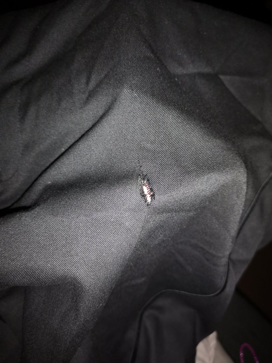 Hopalonglloydy's tweet image. You know you had a great evening of dancing when you look and see holes in your pants where your prosthetic has cut them clean 🤣😍🤣 love my @ottobockuk  #CLegExperience #Freedom #ILikeToMoveItMoveIt 
#BCRTBall2019