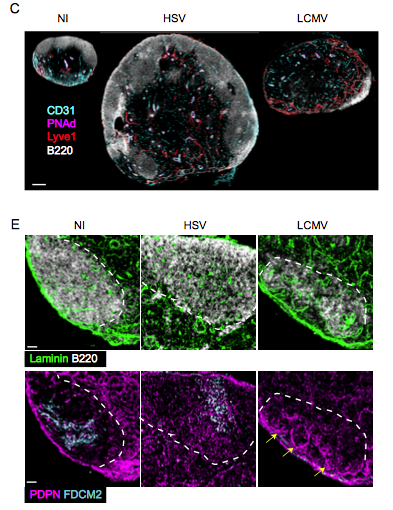 mmw_lmw's tweet photo. #Systemic_Inflammation | suppresses #LymphoidTissue_Remodelling and #B_cell_immunity during concomitant local infection | Scott Mueller @TheDohertyInst @biorxivpreprint https://t.co/nLZi4Nfq9N https://t.co/FUGnH0hLap