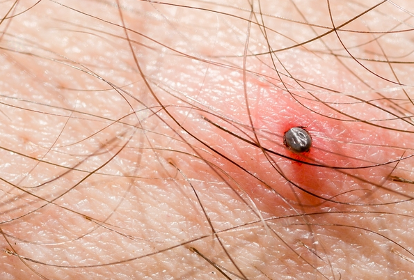 FSeclit's tweet image. HELP: Est ce que quelqu'un sait comment on retire une tique sans la blesser ? 

Quand je dis "blesser", c'est physiquement ET psychologiquement. Je ne voudrais pas non plus qu'elle se sente rejetée.  

#antispécisme #souffranceanimale #droitanimal #éthique