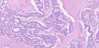 RoyalAuthors's tweet photo. The investigation of #pathology, including the nitty gritty assessment of the #body, In the nineteenth century, #physicians had started to comprehend that sickness causing #pathogens, for example, #bacteria, #viruses, #molds, #protists, and #prions
https://t.co/oefXNGzyVK https://t.co/6XwEej6GcI