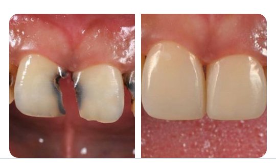 thandi8's tweet photo. @HappyTooth_ZA How much for this procedure? https://t.co/HWNKt5Cvak