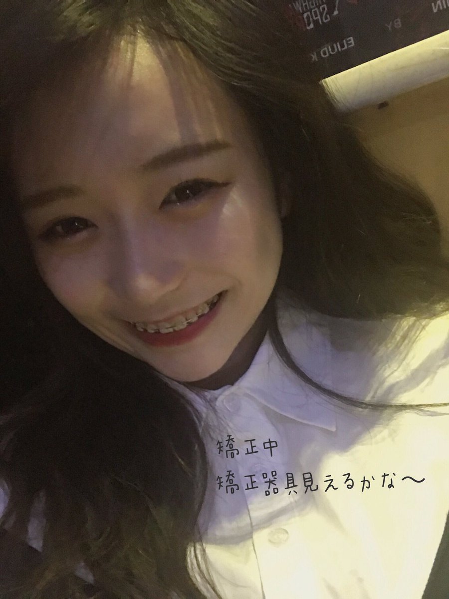 小5で八重歯が生えてきて抜歯してから段々と隙歯になったので13歳で