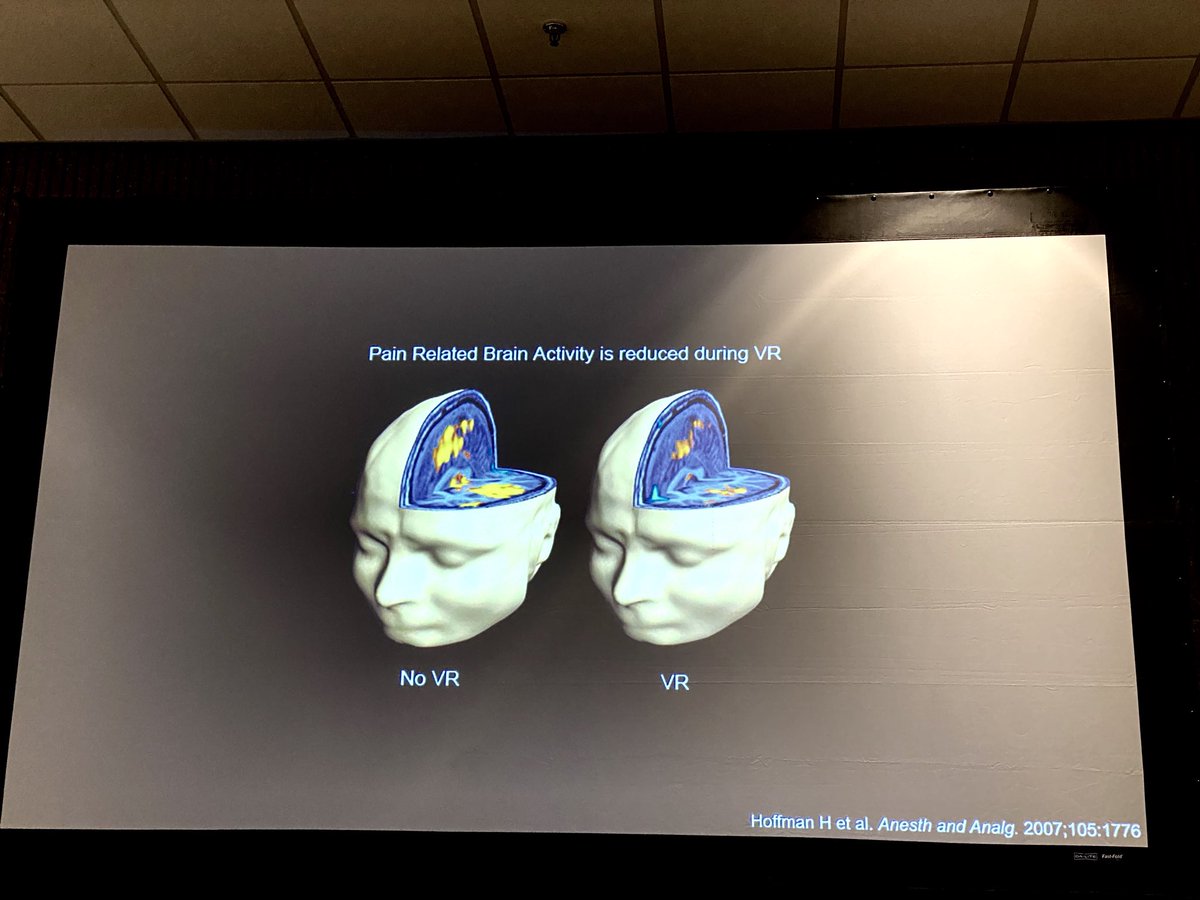 DrBhana's tweet image. Functional MRI showing reduction of Pain with virtual reality via ⁦@BrennanSpiegel⁩ #ACR19 #techmed