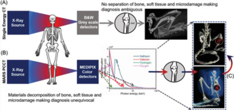 talius's tweet photo. New #X-ray Technology could Revolutionize how Doctors Identify Abnormalities
Using ground-breaking technology, researchers at UMBC and UMB are testing a new method of X-ray imaging that uses #color to identify #microfractures in bones. https://t.co/XADLFXEz9b https://t.co/E0jM6ruKmc