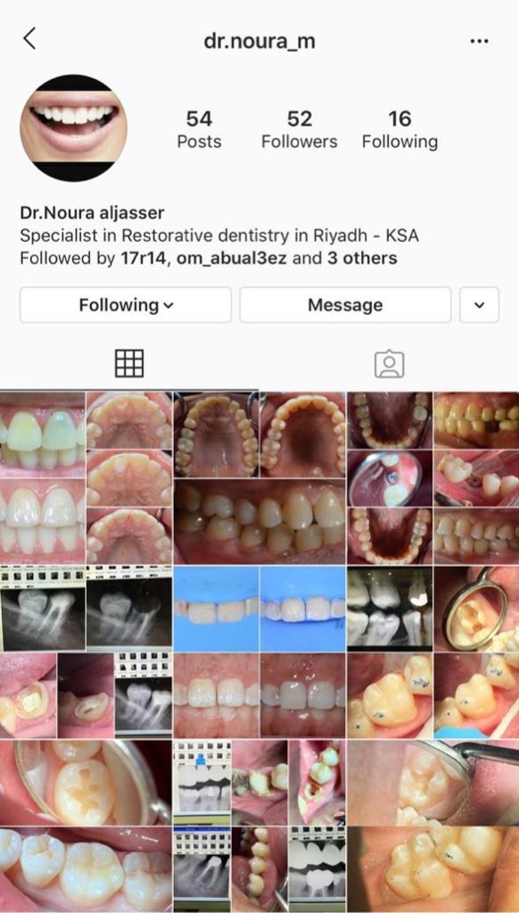 Dentist_List's tweet photo. هذي حاله للدكتوره نوره الجاسر ، تبييض الأسنان Zoom .. https://t.co/tCsi7U1OKJ