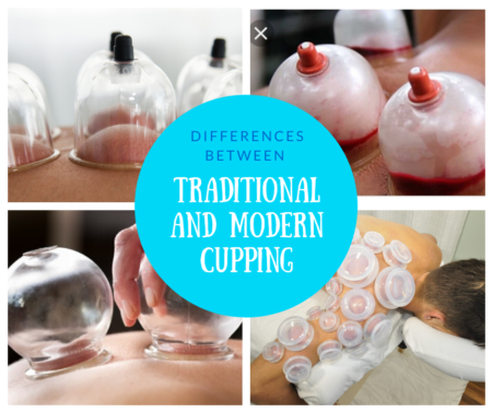 CuppingWarehous's tweet photo. #cupping Wet or Dry? Traditional or Modern? Head on over to #cuppingsecrets to get a detailed comparison of the two most common types of cupping therapy techniques; Traditional cupping vs. Modern cupping. https://t.co/XBvYAmaksL https://t.co/kpWeSY769W