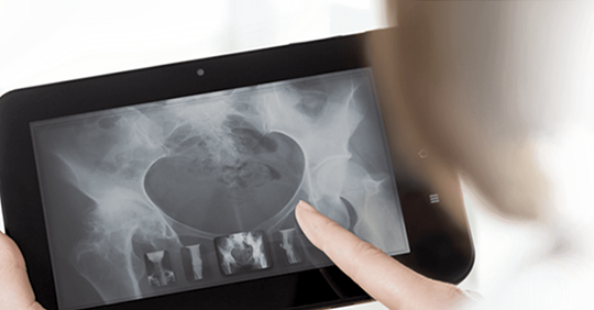actualmedarg's tweet photo. #Actualpacs es la plataforma Secure Cloud de archivado y gestión de imagen médica que permite acceder a sus estudios en la nube a máxima velocidad desde cualquier dispositivo.
Información: https://t.co/Y9shPEaDHA

#radiologia #radiology #teleradiología #teleradiology #radiografia https://t.co/P23QNnKF7y