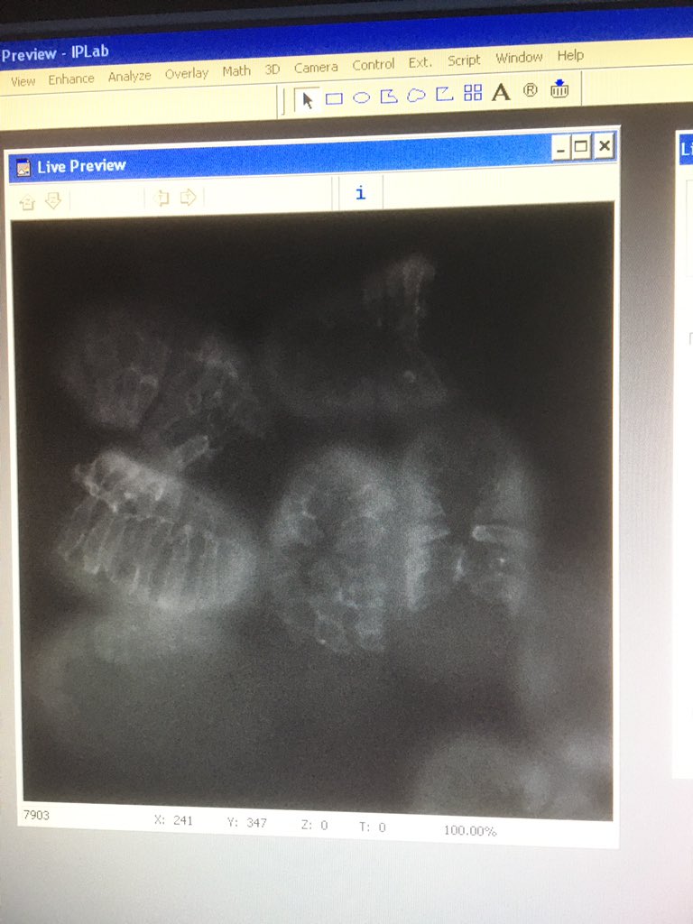 MaidenStephanie's tweet photo. Showing students a GFP-tagged actin-binding protein in the developing epidermis of C. elegans embryos #TSUdevbio #microscopy https://t.co/Gx9aTS6QDn