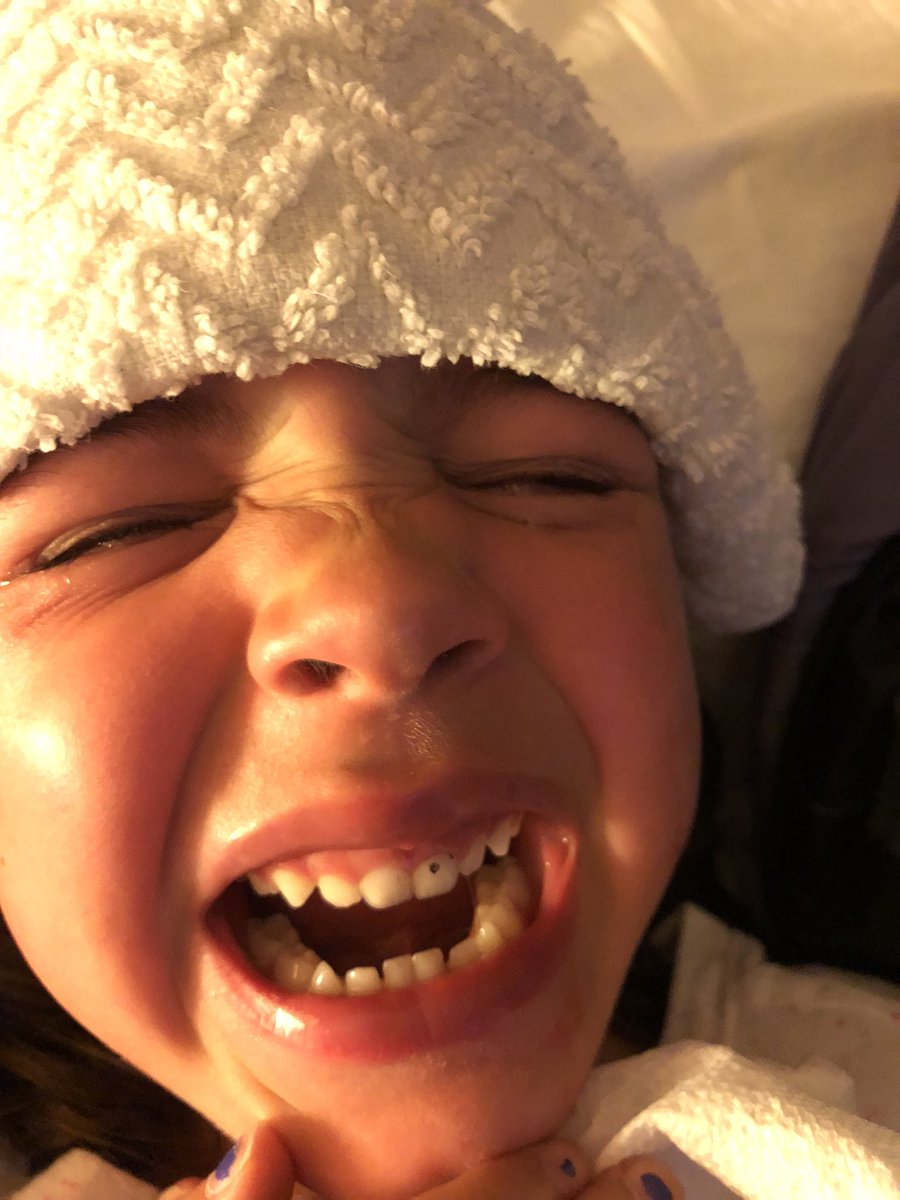 rd197923's tweet photo. My daughter Stella with blacktop in her tooth when she fell off her scooter. she asked me to send this to you all! @phish @treyanastasio @pagemcconnell @mike_gordon @jfishman600 #faceplantintorock #yemsg #phish #finalhurrah #kasvotvaxt https://t.co/iALKo6SpPG