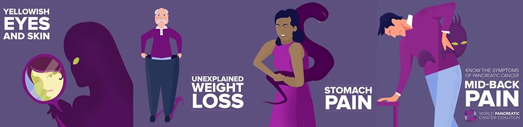 KFRFpc's tweet image. #EarlyDetection is key to survival of #PancreaticCancer. Know the symptoms: abdominal or mid-back pain, unexplained weight loss, jaundice, loss of appetite, indigestion, changes in stool or urine and new-onset diabetes. #WPCD @WorldPancreatic