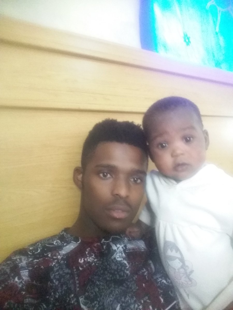 SelulonkeK's tweet photo. My daughter suffers from eczema. It been years now. I treid everything, now am clueless. Sicking for help!! https://t.co/cdYRXvb74E