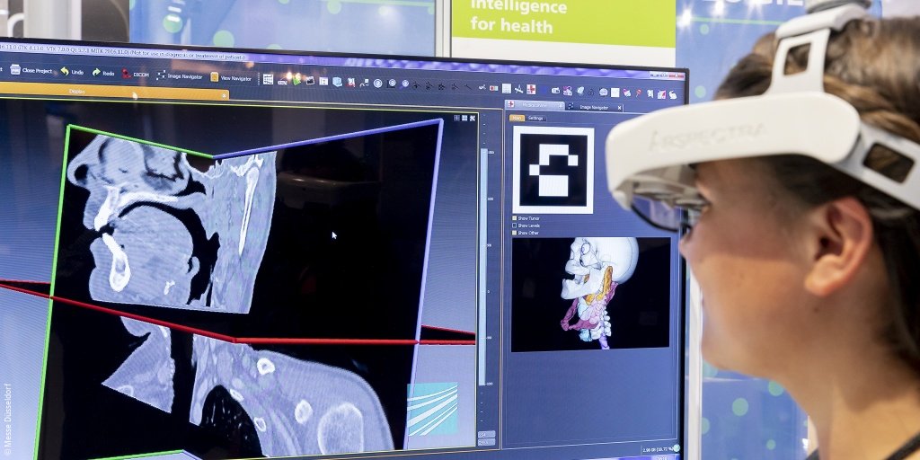 MEDICATradeFair's tweet photo. Ensuring success in #surgical interventions? You can find out how that works with modern imaging techniques in our Trend Topic! https://t.co/KHh0NrJhfz #MEDICA2019 https://t.co/zXRddGpL3y