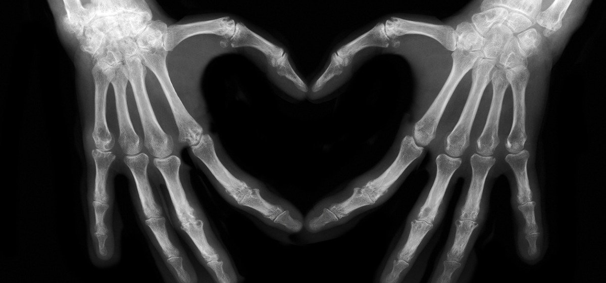 NUH Radiology (@nuhradiology) on Twitter photo In a world where you can be anything, be kind. Happy World Kindness Day @TeamNUH <a href="/mentalhealth/">Mental Health Foundation</a> In a world where you can be anything, be kind. Happy World Kindness Day @TeamNUH <a href="/mentalhealth/">Mental Health Foundation</a>