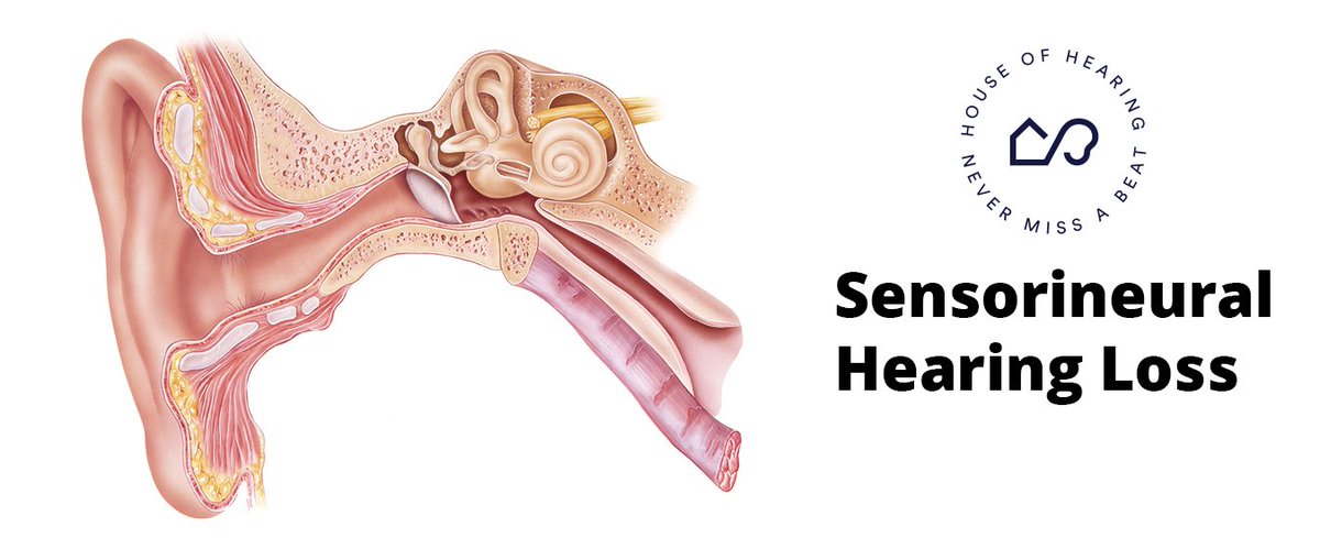 Sensorial hearing loss is probably the most common and well-known form of hearing loss.  

#hearingaids #hearingtest #hearingloss #hearing #ear #oticon #phonak #signia #widex #starkey #hearingaid #sensorineuralhearingloss

houseofhearing.ca/blog/what-is-s…