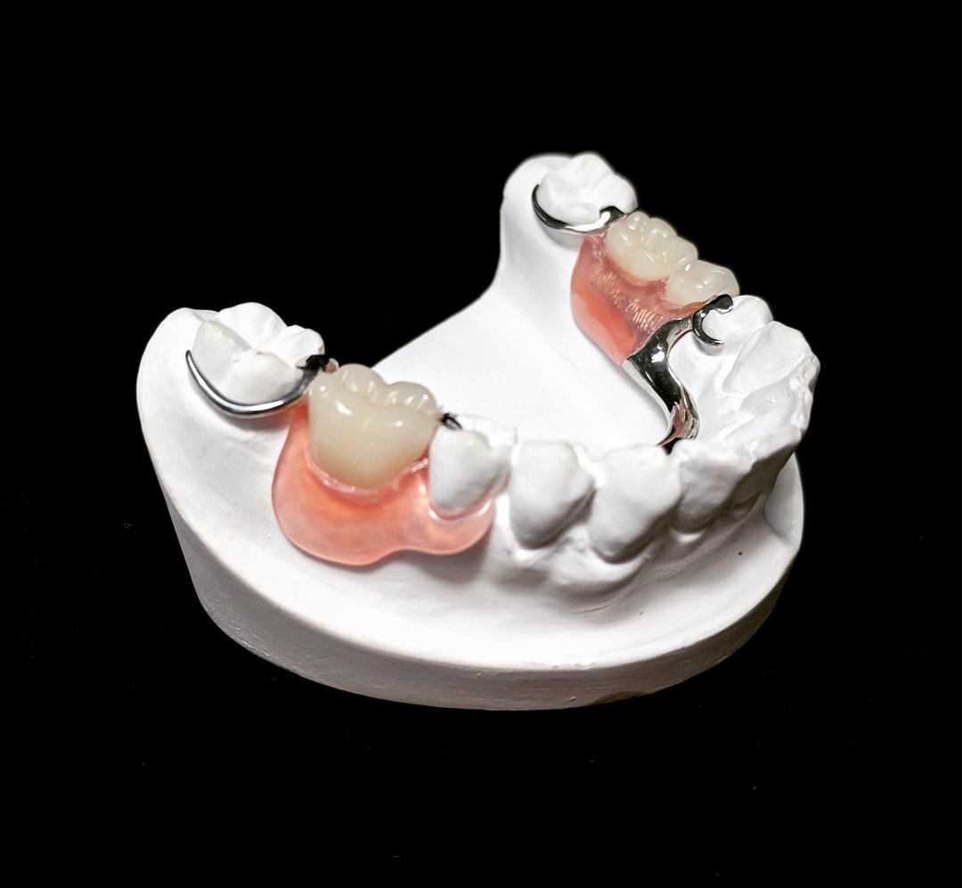 CaputoDental's tweet photo. Valplast® with Vitallium® Frame provides support while relieving excessive pressure and torque on the abutment teeth, creating maximum comfort with superb aesthetics
https://t.co/KO4eDxaq2n #valplast #vita #dentallab #cadcam #teeth #dentaltech #photooftheday #vitallium #denture https://t.co/B7g2Fbxxud