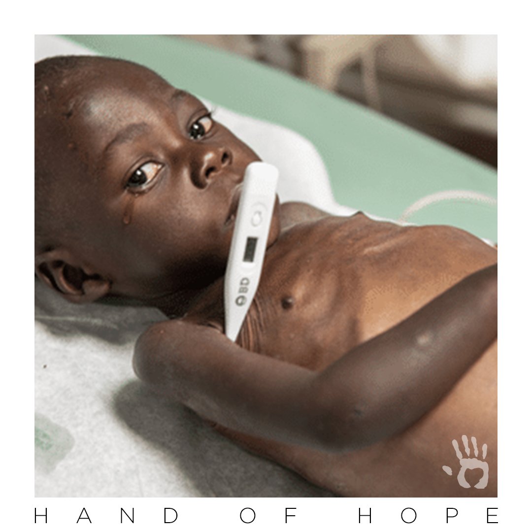 Wadson is from the mountains of Haiti. His father deserted him after his mother died. A neighbor, with eight children of her own, took him in and brought him to the Jesus Healing Center. We are hopeful and praying that he makes a full recovery!