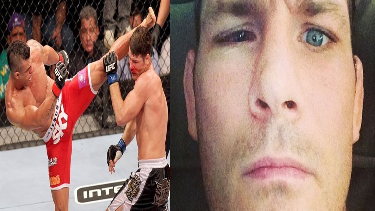 EdwardAB6's tweet photo. @bisping YOU ONLY LIVE ONE, OR AT LEAST THATS WHAT THEY SAY, LIVE LIFE2 THE FULLEST, U HAVE THE OPPORTUNITY/ABILITY 2JUST PICK UP THE PHONE RING DANA/SCOTT COKER &amp; OR ONES C.E.O4 A 1 IF NOT 2 FIGHT DEAL FOR THESE IDEAL FIGHTS, SO LETS GET IT&amp; MAKE IT HAPPEN #FORGIVEBUTNEVERFORGET https://t.co/FSzjHmVXWG