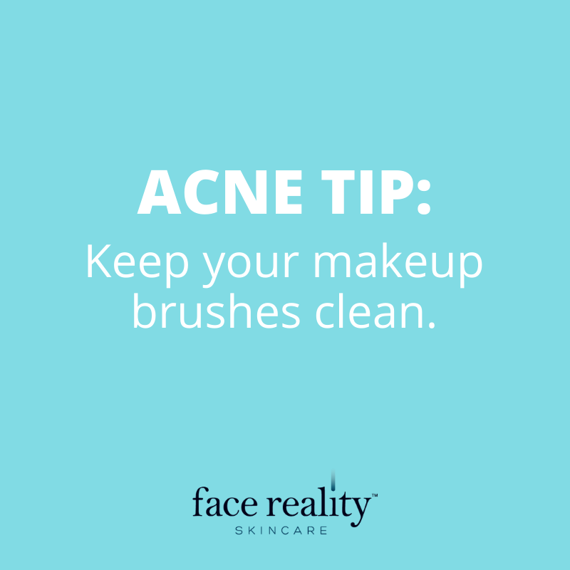 FaceRealityAcne's tweet photo. Makeup brushes can harbor some gnarly bacteria and debris! Our Ultra Gentle Cleanser is an excellent acne-safe brush cleanser. Can you say 2 for 1?! https://t.co/ANjcmTJ9hE