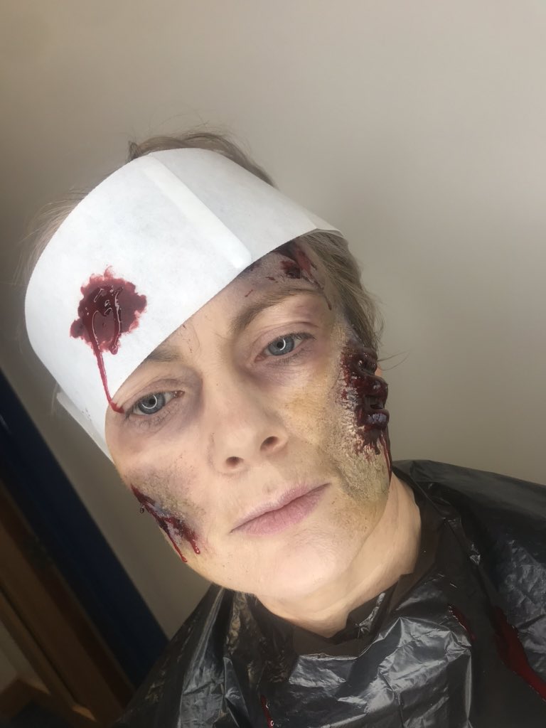 Claudiaadaid's tweet image. Casualty horror done ✅ #makeupartist #casualtyhorror #assignmentdone