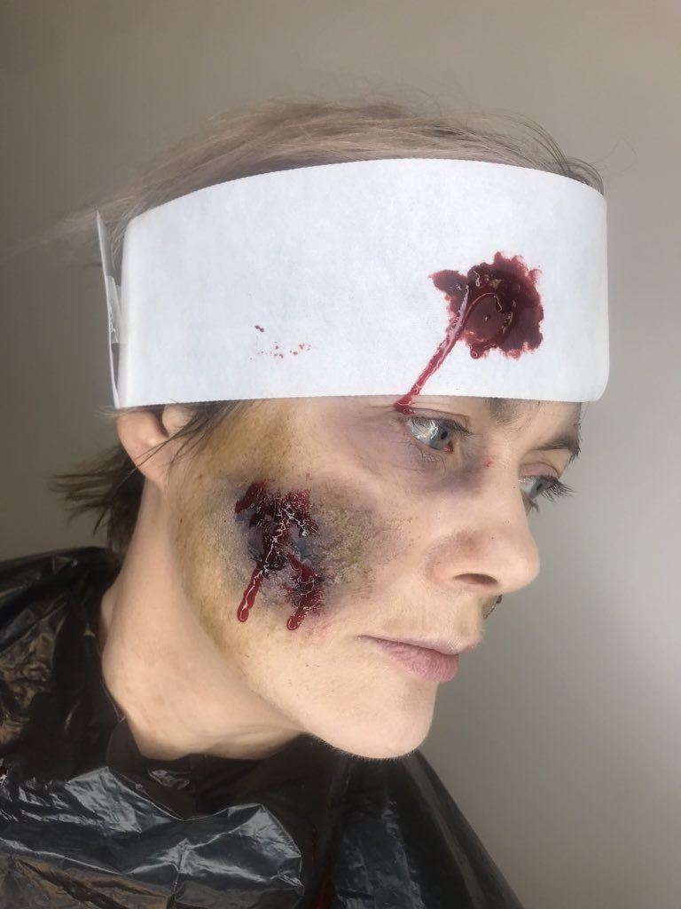 Claudiaadaid's tweet image. Casualty horror done ✅ #makeupartist #casualtyhorror #assignmentdone