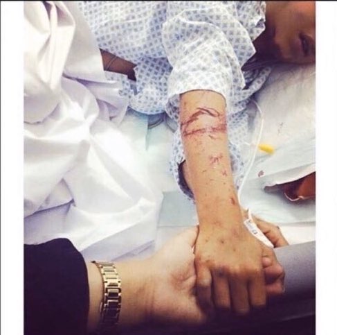 AbtTrend's tweet photo. #حنين_تنخى_وجة_السعد

هاشتاق تم رفعه دعمًا لفتاه تدعى حنين سالم بعمر ١٤ سنة، يقال أنها تعرضت للتعنيف من قِبَل والدتها واخوتها بعد وفاة والدها، وتطالب بإيصال صوتها. https://t.co/odQ0VMcSSr
