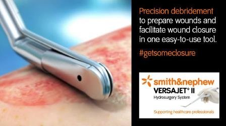 smithnephew's tweet photo. Routine task, uncommon precision. #VERSAJET II is designed for intuitive, efficient debridement, promoting tissue preservation & wound closure. Make it your one tool for routine practice & #getsomeclosure. Helping you get #closerto0 delay in wound healing: https://t.co/CxAPPk8qGd https://t.co/CJKtmWLJI3