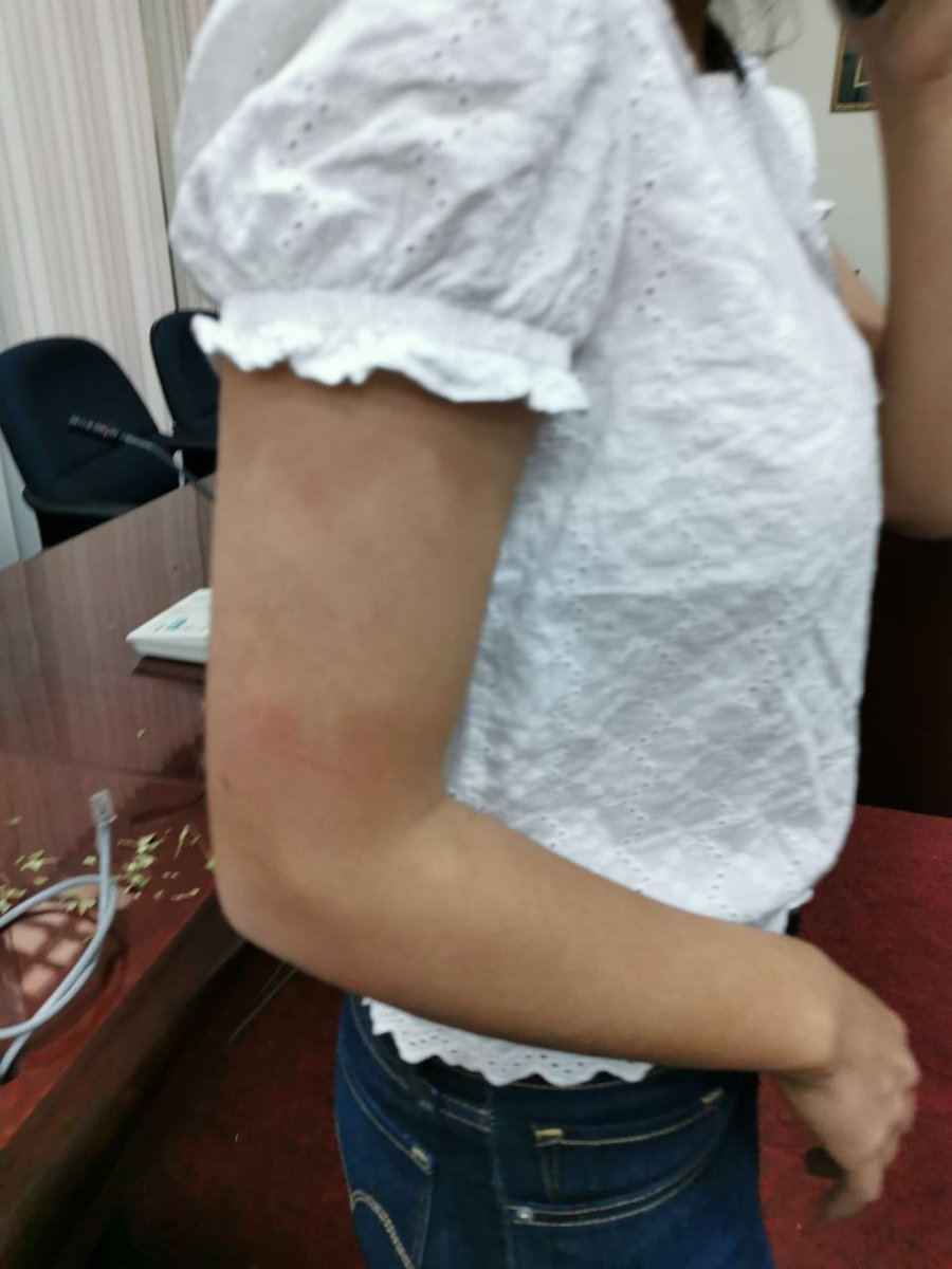 LaSuchel_'s tweet photo. La golpista asesina @JeanineAnez dijo que iba a dar garantías a los asambleístas del MAS, estas son esas garantías, nuestras asambleístas golpeadas y con sus familias amenazadas

#GolpeDeEstadoEnBolivia
#EvoTieneQueVolver
#RenunciaAñez
@ActualidadRT @teleSURtv @evoespueblo https://t.co/TNailSrdHa