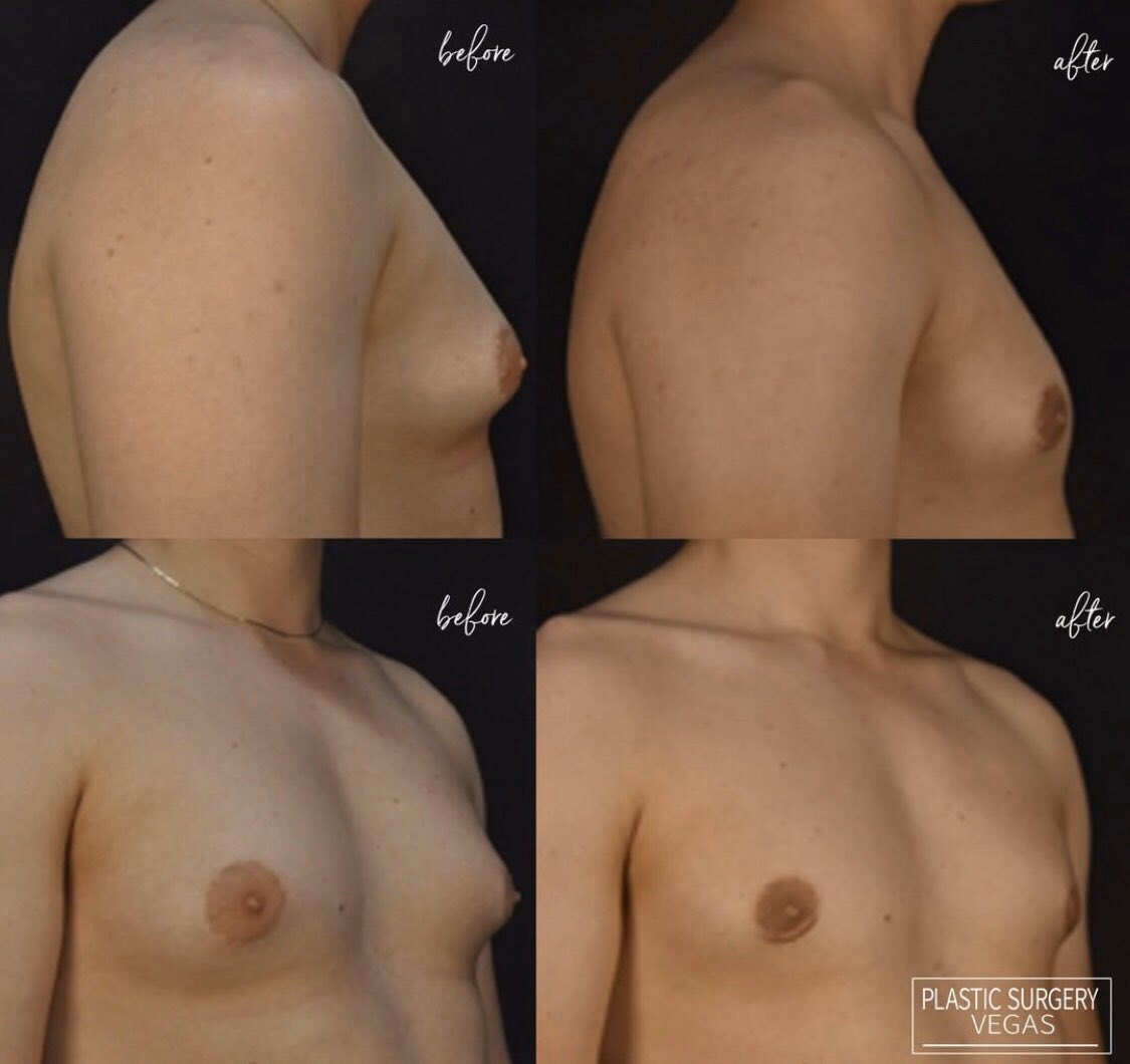 PlasticSurgeryVegas tweet media