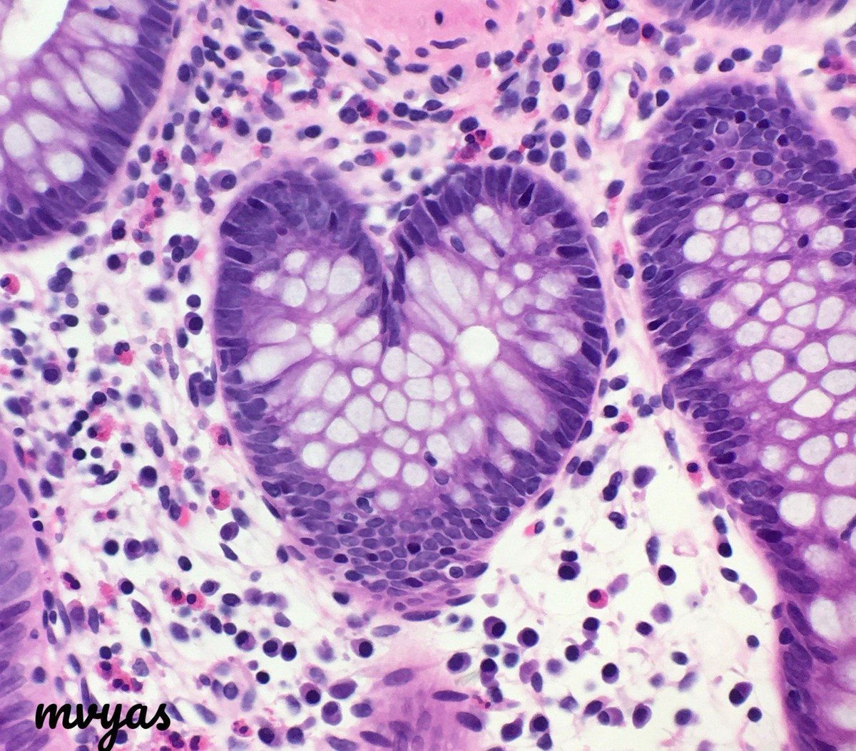 #InternationalPathologyDay
Isn't it great when you say I love #pathology and pathology ❤️s you right back 😄
Happy #PathologyDay to all you wonderful pathologists!