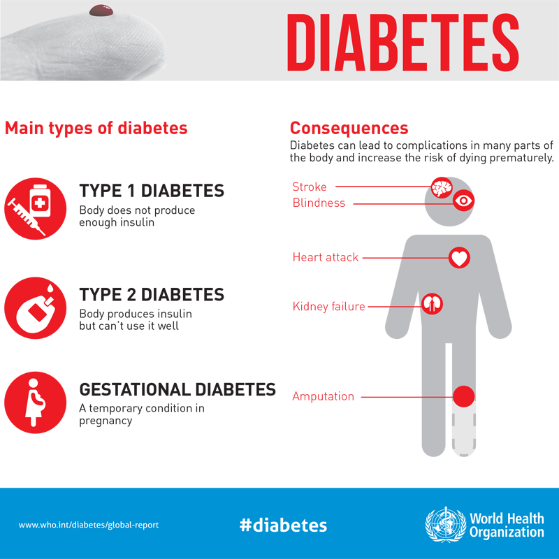 WHOSEARO's tweet photo. @WHO @GujHFWDept @beatNCDs @WDD @MoHFW_INDIA @MoHmv @HIA_NCD @WHOTimorLeste @un_ncd @NHPINDIA @HFWOdisha @MoHFW_GUJARAT @WHOMaldives @WHOSriLanka @WHOThailand @PIB_India @WHOIndonesia Today is #WorldDiabetesDay2019 

Here are the main types of #diabetes and their consequences: https://t.co/87uS9J8vqg