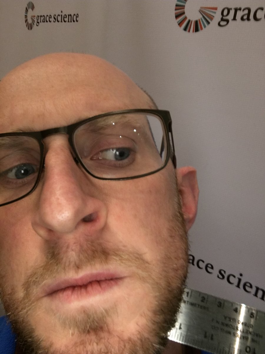 theWillMueller's tweet photo. Day 13 of #NoShaveNovember #Movember for #NGLY1 and cancer. I have #LetItGrow to ~0.6cm or 1/4 of an inch.

Please go to my @gracescience #TakeAction page to donate to support some scientific growth!

https://t.co/rxI4ufpeOk https://t.co/nidvHo5xVx